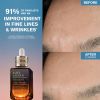 Recensioni del complesso multi-recupero sincronizzato Advanced Night Repair Serum