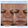 Siero Clarifique Pro-Solution