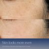 Recensioni del complesso multi-recupero sincronizzato Advanced Night Repair Serum