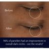 Advanced Night Repair Eye Crema gel-crema potenziata per gli occhi in un barattolo in edizione limitata