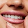 Rossetto gelido