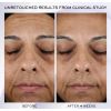 Rénergie HPN 300-Crema peptidica