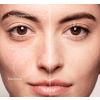 Correttore Mini Skin a copertura totale